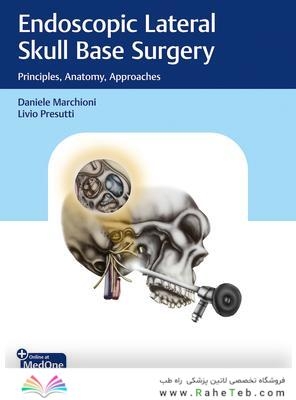 Endoscopic Lateral Skull Base Surgery
