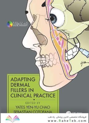 Adapting Dermal Fillers in Clinical Practice