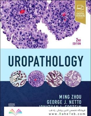 Uropathology E-Book 2nd Edición