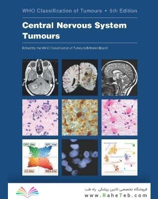 Central Nervous System Tumours (WHO Classification of Tumours) 5th Edición