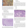 Robbins and Cotran Review of Pathology (Robbins Pathology) 5th Edicion
