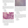 Robbins and Cotran Review of Pathology (Robbins Pathology) 5th Edicion