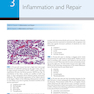 Robbins and Cotran Review of Pathology (Robbins Pathology) 5th Edicion