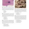 Robbins and Cotran Review of Pathology (Robbins Pathology) 5th Edicion