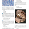Robbins and Cotran Review of Pathology (Robbins Pathology) 5th Edicion