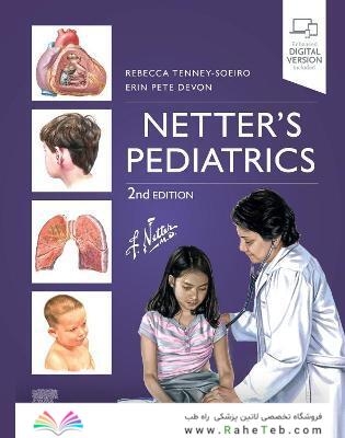Netter