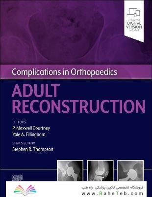 Complications in Orthopaedics: Adult Reconstruction 1st Edición