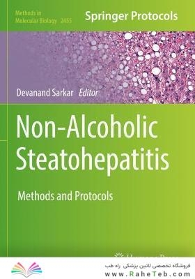 Non-Alcoholic Steatohepatitis : Methods and Protocols