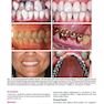 Contemporary Fixed Prosthodontics 6th Edition2023