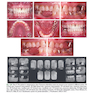 Contemporary Fixed Prosthodontics 6th Edition2023