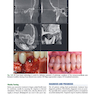 Contemporary Fixed Prosthodontics 6th Edition2023