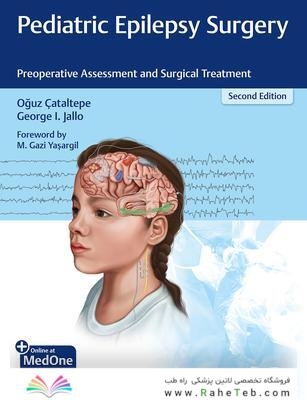 Pediatric Epilepsy Surgery : Preoperative Assessment and Surgical Treatment 2nd Edition