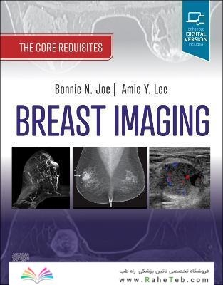 Breast Imaging : The Core Requisites 4th Edition