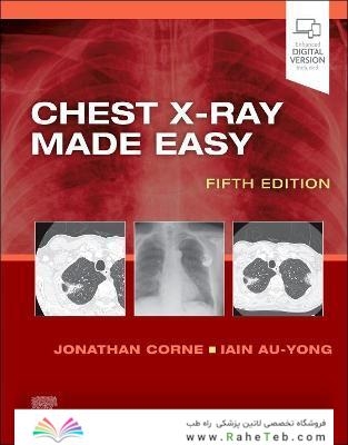 Chest X-Ray Made Easy 5th Edition