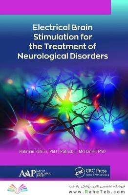 Electrical Brain Stimulation for the Treatment of Neurological Disorders 1st Edition