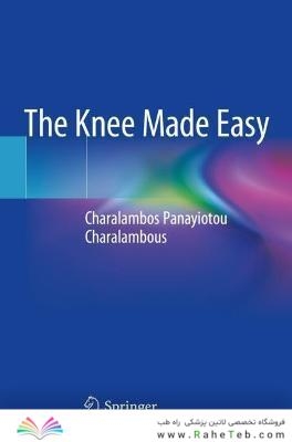The Knee Made Easy
