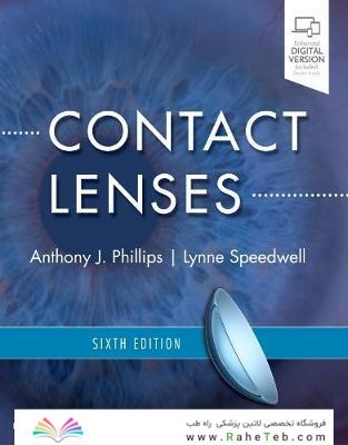 Contact Lenses, 6th Edition