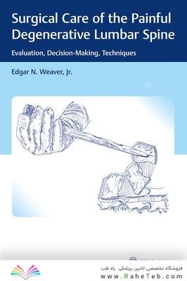 Surgical Care of the Painful Degenerative Lumbar Spine : Evaluation, Decision-Making, Techniques