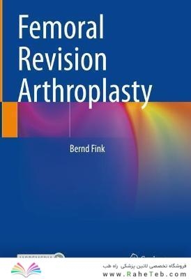 Femoral Revision Arthroplasty
