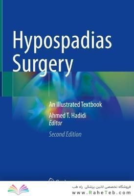 Hypospadias Surgery : An Illustrated Textbook