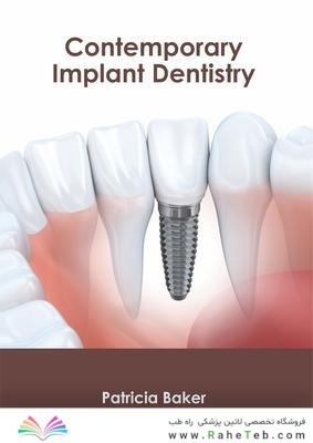 Contemporary Implant Dentistry