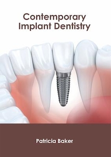 عکس Contemporary Implant Dentistry