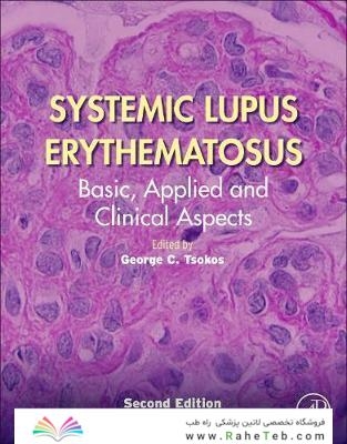 Systemic Lupus Erythematosus : Basic, Applied and Clinical Aspects