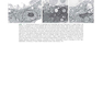 Robbins - Kumar Basic Pathology 11th Edicion