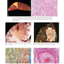 Robbins - Kumar Basic Pathology 11th Edicion
