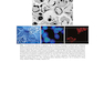 Robbins - Kumar Basic Pathology 11th Edicion