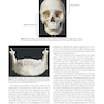 Atlas of Oral and Maxillofacial Surgery - 2nd Edicion