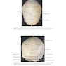 Atlas of Oral and Maxillofacial Surgery - 2nd Edicion
