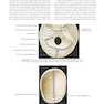 Atlas of Oral and Maxillofacial Surgery - 2nd Edicion