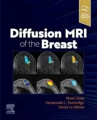 عکس DIFFUSION MRI OF THE BREAST, E-Book
