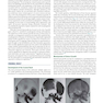 Orthodontics : Current Principles and Techniques