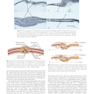 Orthodontics : Current Principles and Techniques