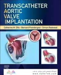 Transcatheter Aortic Valve Implantation
