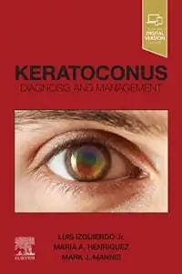 عکس Keratoconus,E-Book: Diagnosis and Management