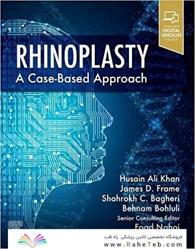 Rhinoplasty: a Case-based approach