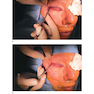 Facial Paralysis A Comprehensive Rehabilitative Approach