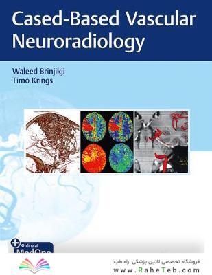 Imaging in Neurovascular Disease A Case-Based Approach