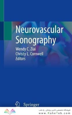 Neurovascular Sonography