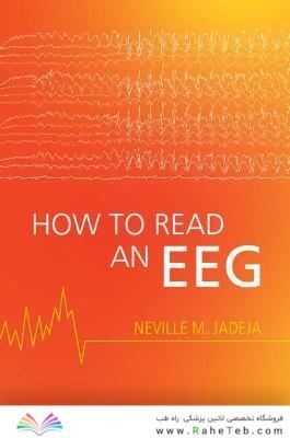 How to Read an EEG