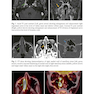Challenging Cases in Neurologic Localization: An Evidence-Based Guide