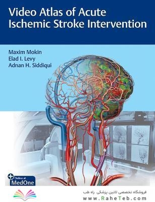 Video Atlas of Acute Ischemic Stroke Intervention