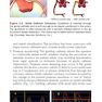 The Interventional Cardiac Catheterization Handbook
