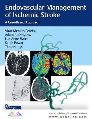 Endovascular Management of Ischemic Stroke : A Case-Based Approach