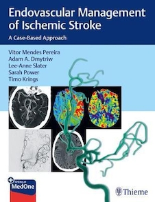 عکس Endovascular Management of Ischemic Stroke : A Case-Based Approach