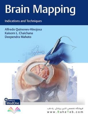 Brain Mapping Indications and Techniques