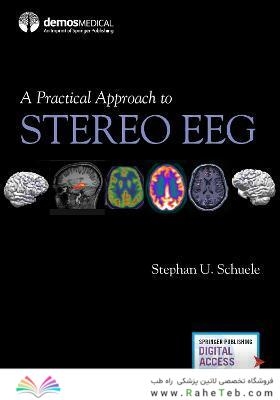 A Practical Approach to Stereo EEG